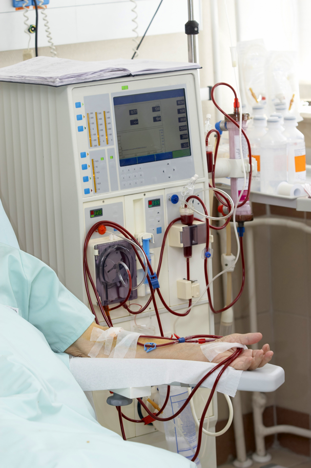 Bed blocking renal - o problema da diálise na UTI